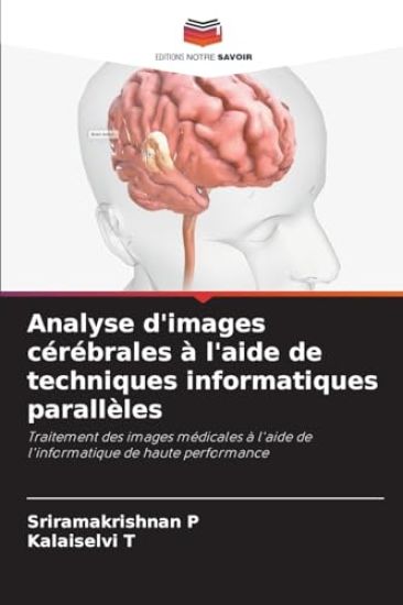 Analyse d'images cérébrales à l'aide de techniques informatiques parallèles