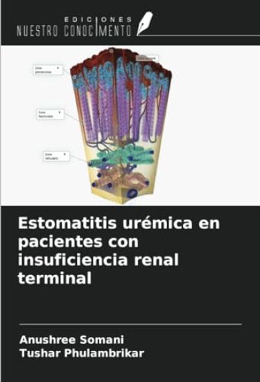 Estomatitis urémica en pacientes con insuficiencia renal terminal