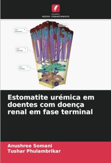 Estomatite urémica em doentes com doença renal em fase terminal