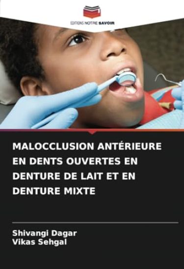 Malocclusion Antérieure En Dents Ouvertes En Denture de Lait Et En Denture Mixte