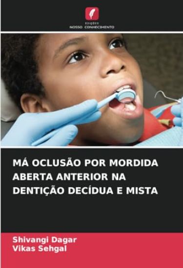 MÁ Oclusão Por Mordida Aberta Anterior Na Dentição Decídua E Mista