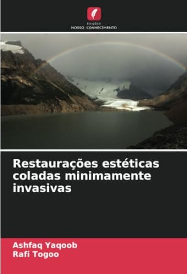 Restaurações estéticas coladas minimamente invasivas