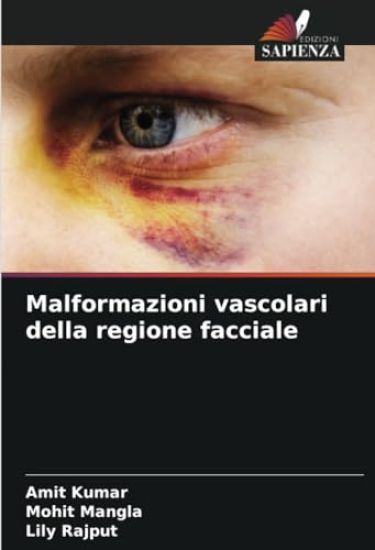 Malformazioni vascolari della regione facciale