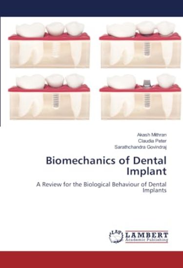 Biomechanics of Dental Implant