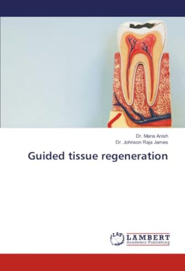 Guided tissue regeneration