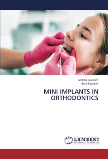 Mini Implants in Orthodontics