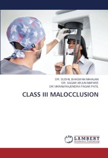 Class III Malocclusion