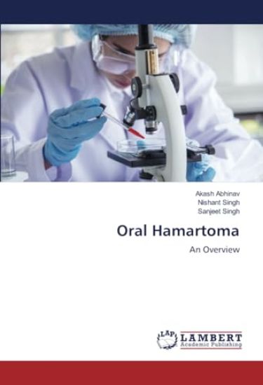 Oral Hamartoma