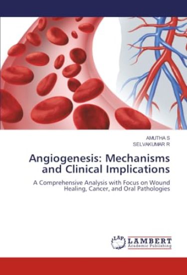 Angiogenesis