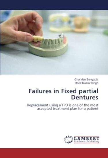 Failures in Fixed partial Dentures