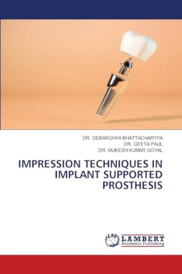 Impression Techniques in Implant Supported Prosthesis