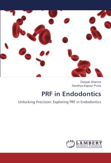 PRF in Endodontics