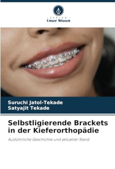 Selbstligierende Brackets in der Kieferorthopädie