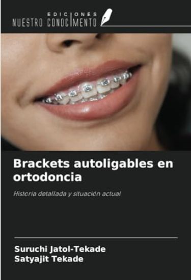 Brackets autoligables en ortodoncia