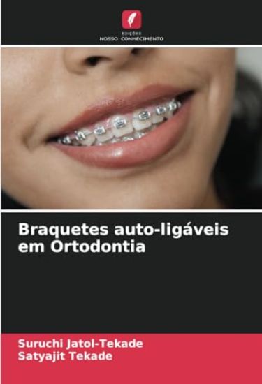 Braquetes auto-ligáveis em Ortodontia