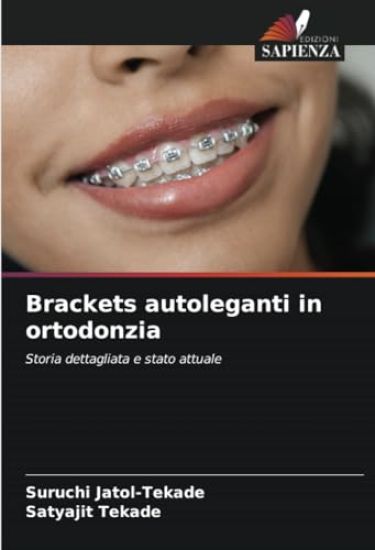 Brackets autoleganti in ortodonzia