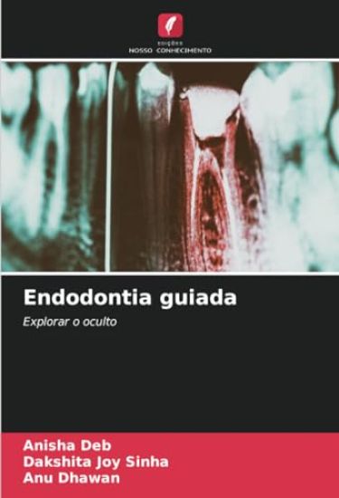Endodontia guiada