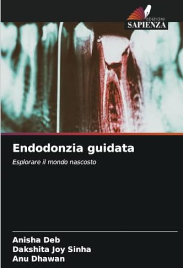Endodonzia guidata