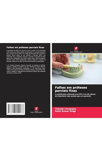 Falhas em próteses parciais fixas