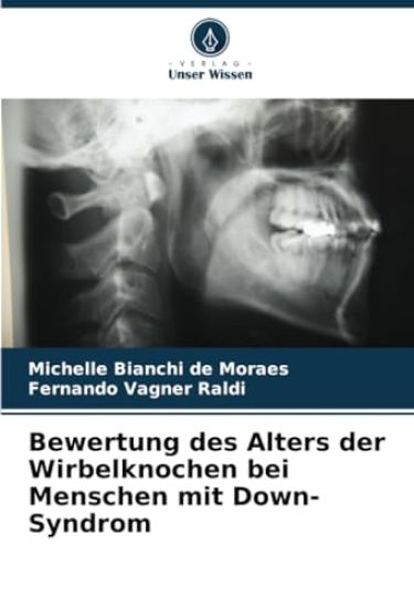 Bewertung des Alters der Wirbelknochen bei Menschen mit Down-Syndrom