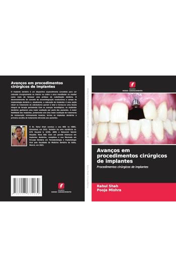 Avanços em procedimentos cirúrgicos de implantes