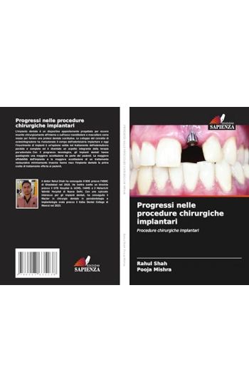 Progressi nelle procedure chirurgiche implantari