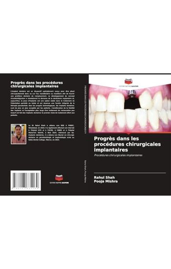 Progrès dans les procédures chirurgicales implantaires