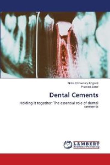 Dental Cements