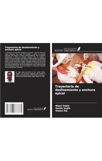 Trayectoria de deslizamiento y anchura apical