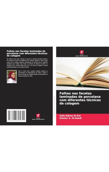 Falhas nas facetas laminadas de porcelana com diferentes técnicas de colagem