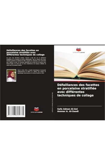 Défaillances des facettes en porcelaine stratifiée avec différentes techniques de collage