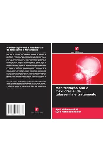 Manifestação oral e maxilofacial da talassemia e tratamento
