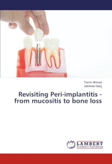 Revisiting Peri-implantitis - from mucositis to bone loss