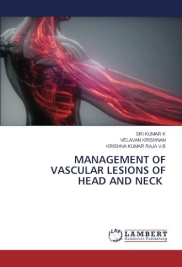 Management of Vascular Lesions of Head and Neck