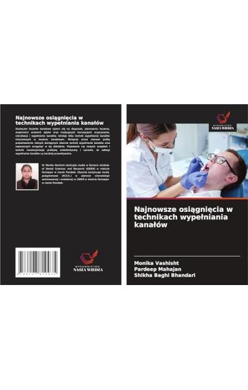 Najnowsze osiagniecia w technikach wypelniania kanalów