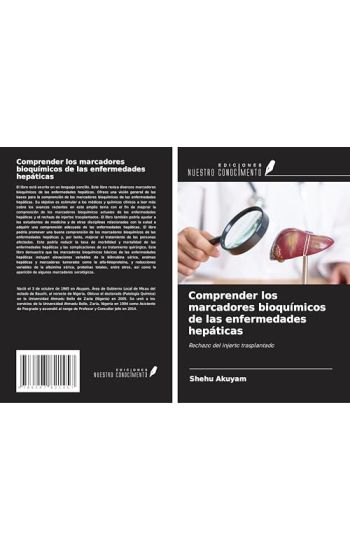 Comprender los marcadores bioquímicos de las enfermedades hepáticas