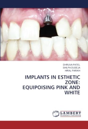 Implants in Esthetic Zone