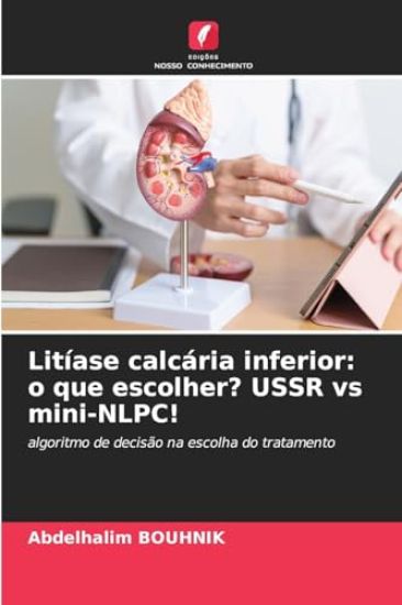 Litíase calcária inferior
