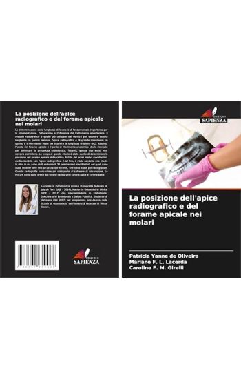 La posizione dell'apice radiografico e del forame apicale nei molari
