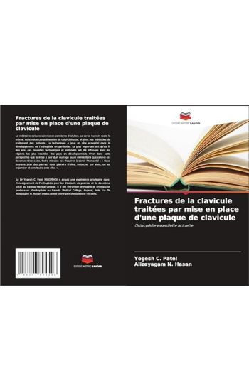 Fractures de la clavicule traitées par mise en place d'une plaque de clavicule