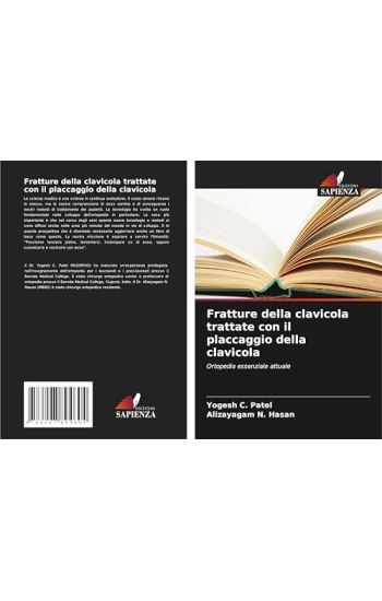 Fratture della clavicola trattate con il placcaggio della clavicola