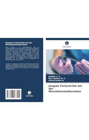 Jüngste Fortschritte bei der Wurzelkanalobturation