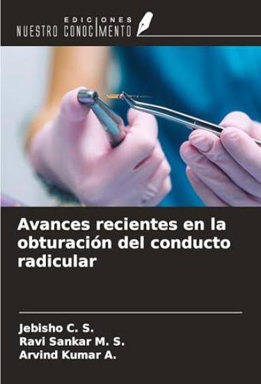 Avances recientes en la obturación del conducto radicular