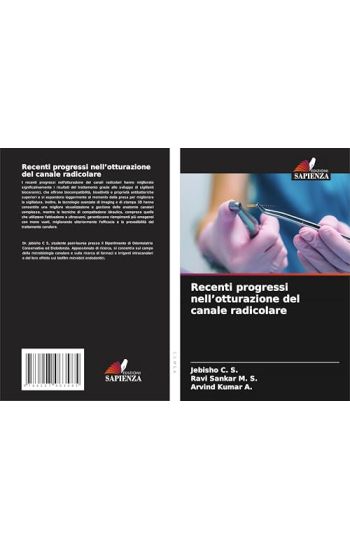 Recenti progressi nell'otturazione del canale radicolare