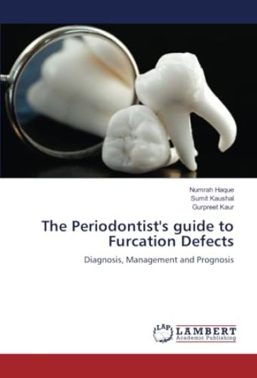 The Periodontist's guide to Furcation Defects