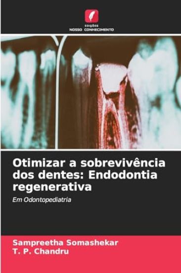 Otimizar a sobrevivência dos dentes
