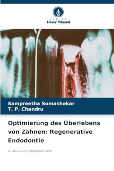 Optimierung des Überlebens von Zähnen