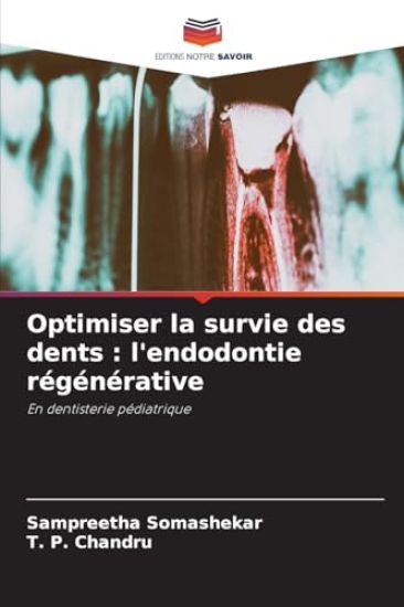 Optimiser la survie des dents