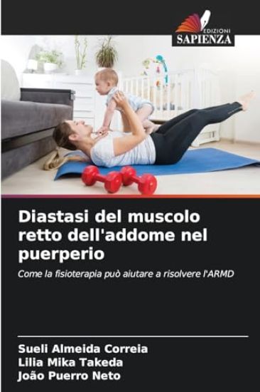 Diastasi del muscolo retto dell'addome nel puerperio