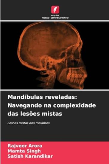 Mandíbulas reveladas